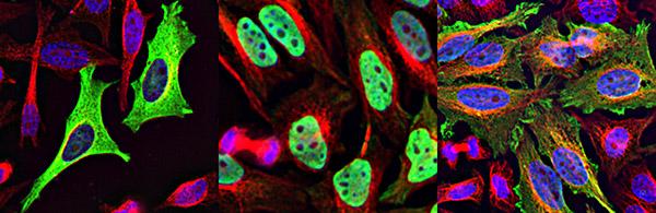 HeLa Cells, UC San Diego School of Medicine