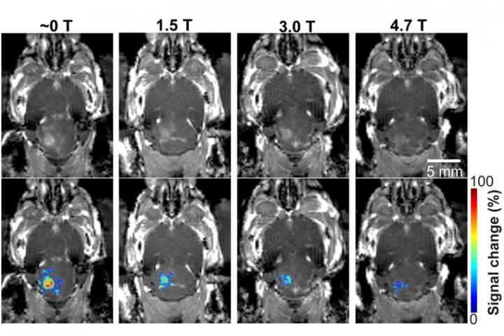 Microbubble cavitation signal and decreased BBB opening volume