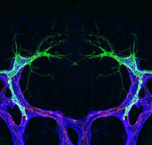 Microscopic image of sprouting blood vessels in the retina of the eye