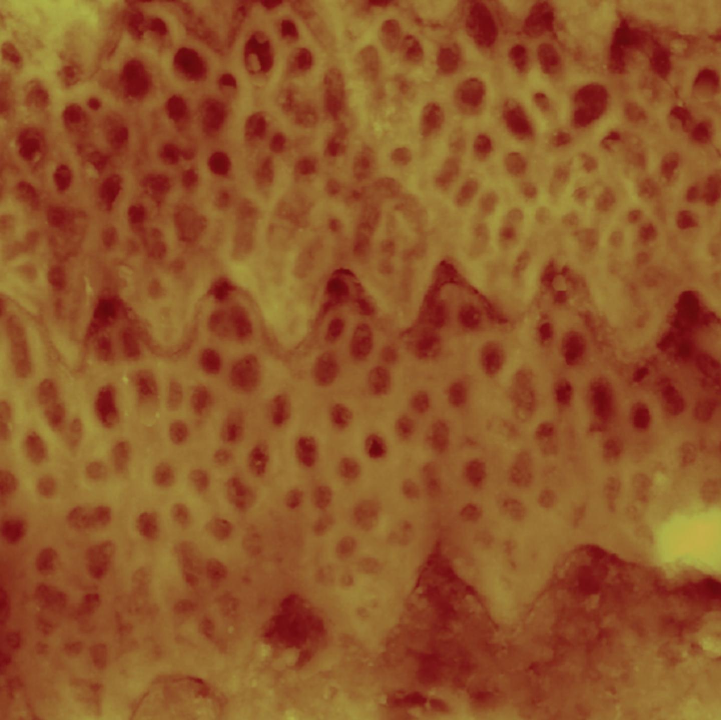 Microstructures from sidewinder snake