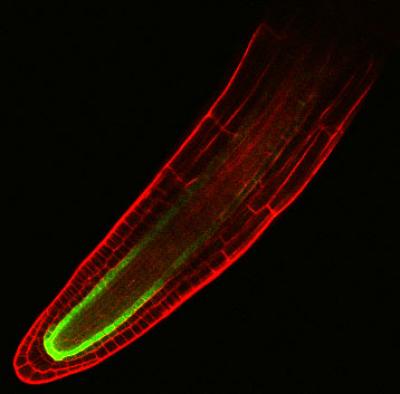 Salt Affecting Root Cells