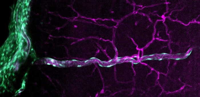 Close-up image of a fibroblast (green) with penetrating vessel (magenta) in the cortex of a mouse brain.