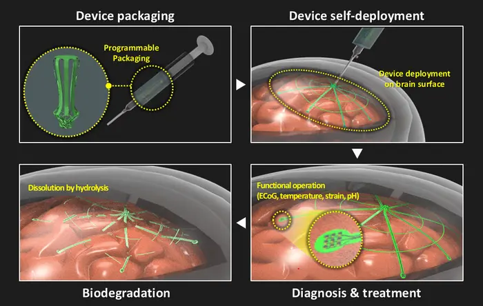 Figure 1. Process of minimally invasive large-area brain surface electrode insertion using a biodegradable electronic tent