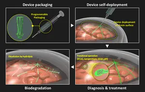 Figure 1. Process of minimally invasive large-area brain surface electrode insertion using a biodegradable electronic tent