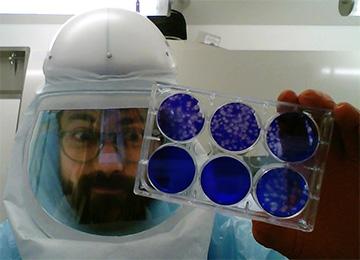 Jesse Erasmas COVID-19 Tissue Culture Plate