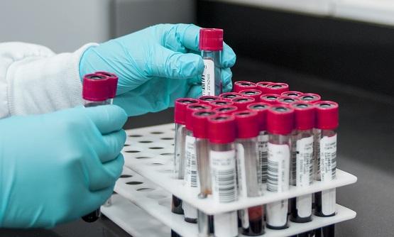 New Method May Allow Country-Level Real-Time Surveillance of Drug-Resistant Tuberculosis