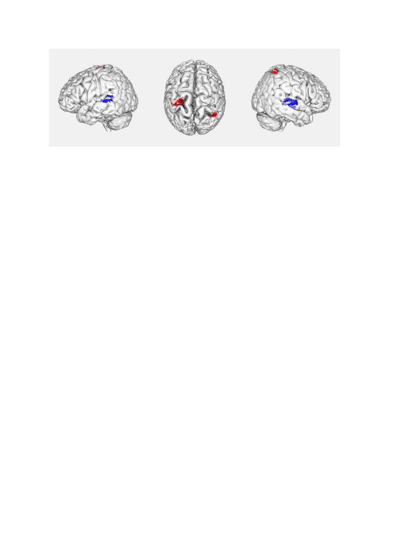 Differing Brain Activation Depending on Speaker Origin