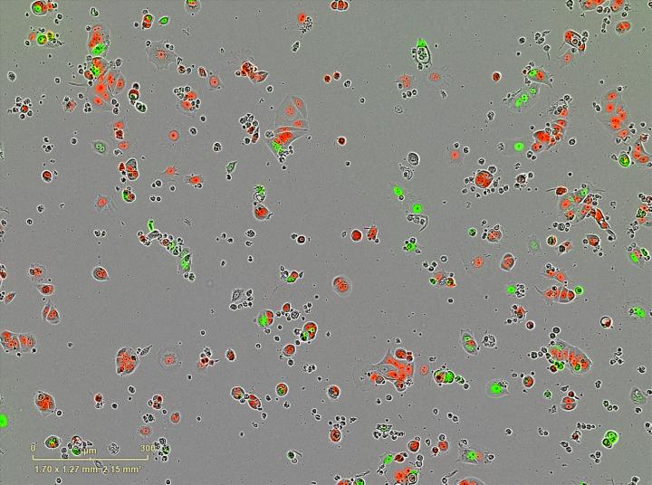 Breast Cancer Sleeper Cells