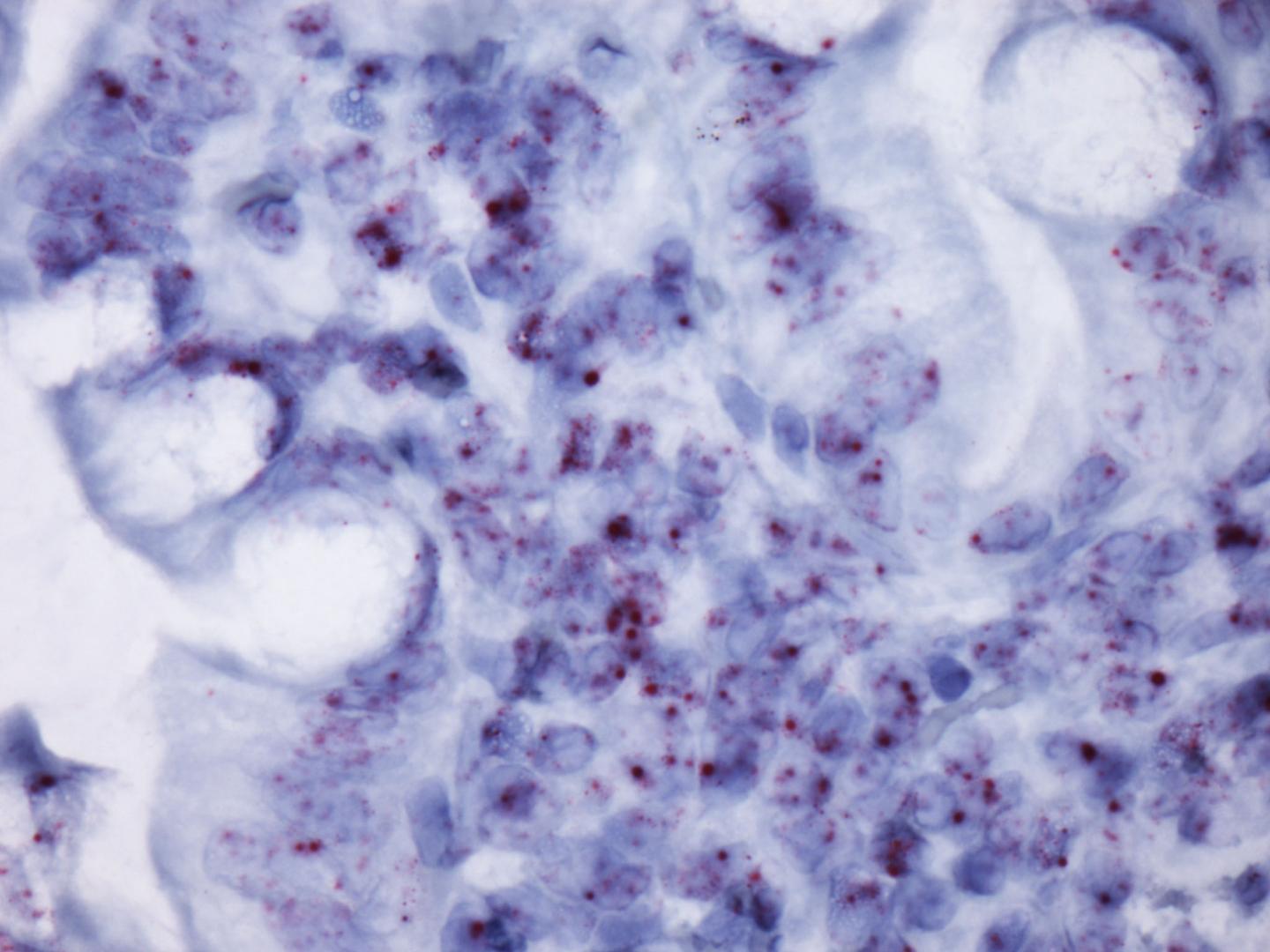 Photomicrograph Showing the lnc13 RNA Expression