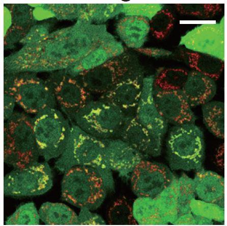 Researchers Link New Protein to Parkinson's