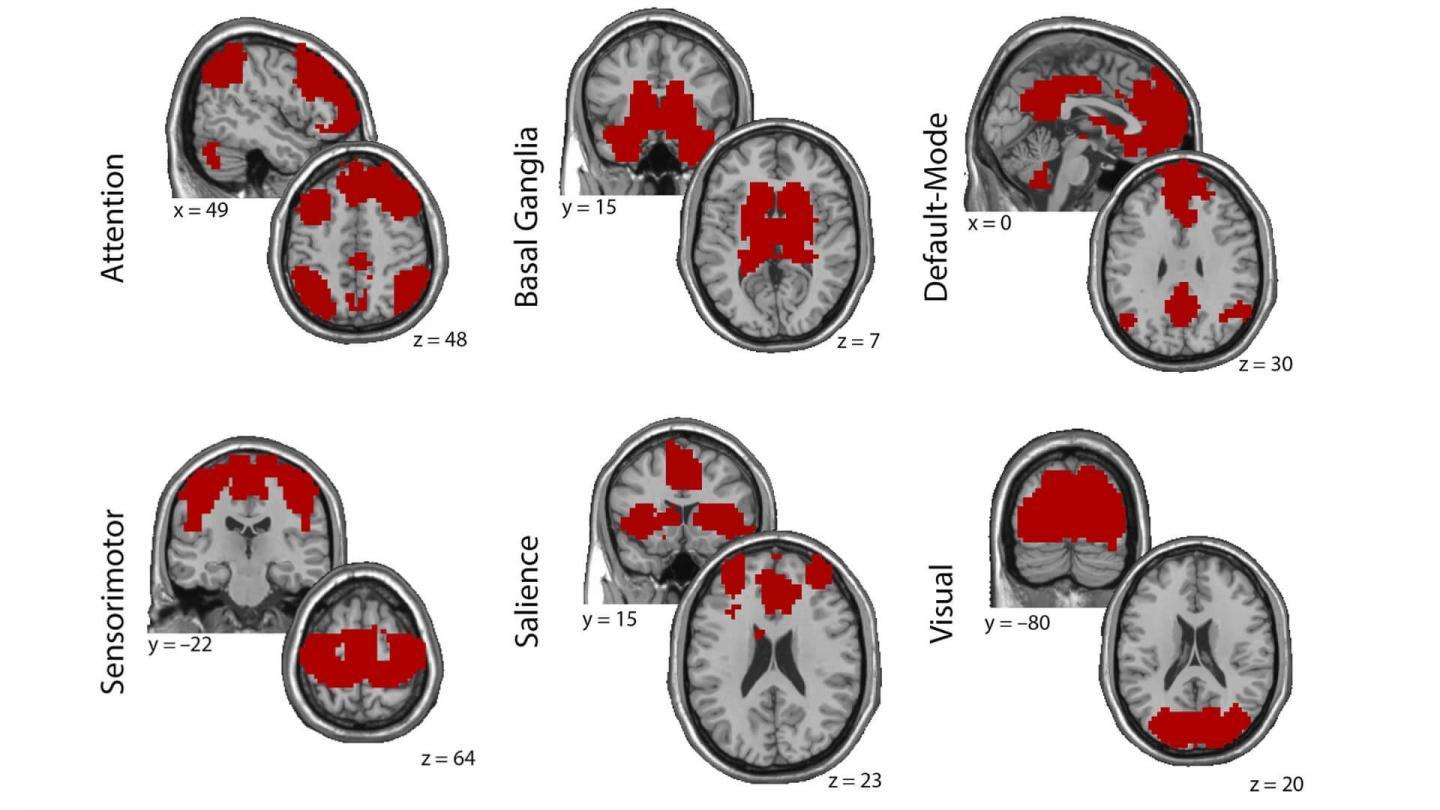 Brain Maps from Brain Functional Connectivity Study