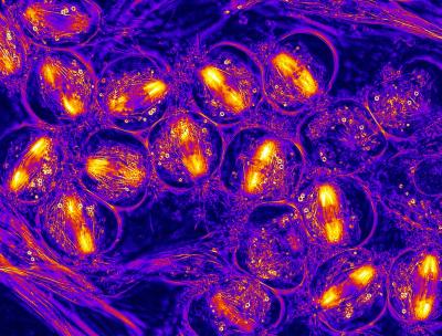 LC-PolScope Crane Fly Spermatocytes