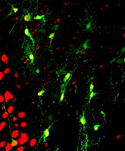 Brain Repair after Injury and Alzheimer's Disease