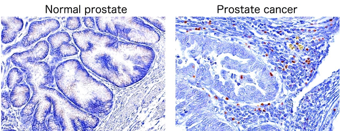 Infiltration of regulatory T cells in canine spontaneous prostate cancer