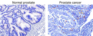 Infiltration of regulatory T c [IMAGE] | EurekAlert! Science News Releases