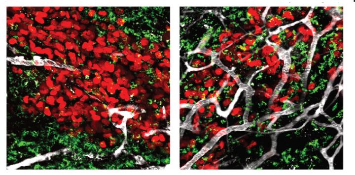 Cancer Treatments Combine Forces to Infiltrate Previously Unreachable Tumors (3 of 3)