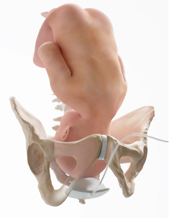 Fetal Pillow. Image reproduced courtesy of Cooper Surgical, Inc.
