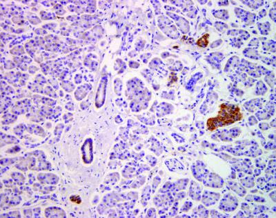 Healthy Pancreas Tissue