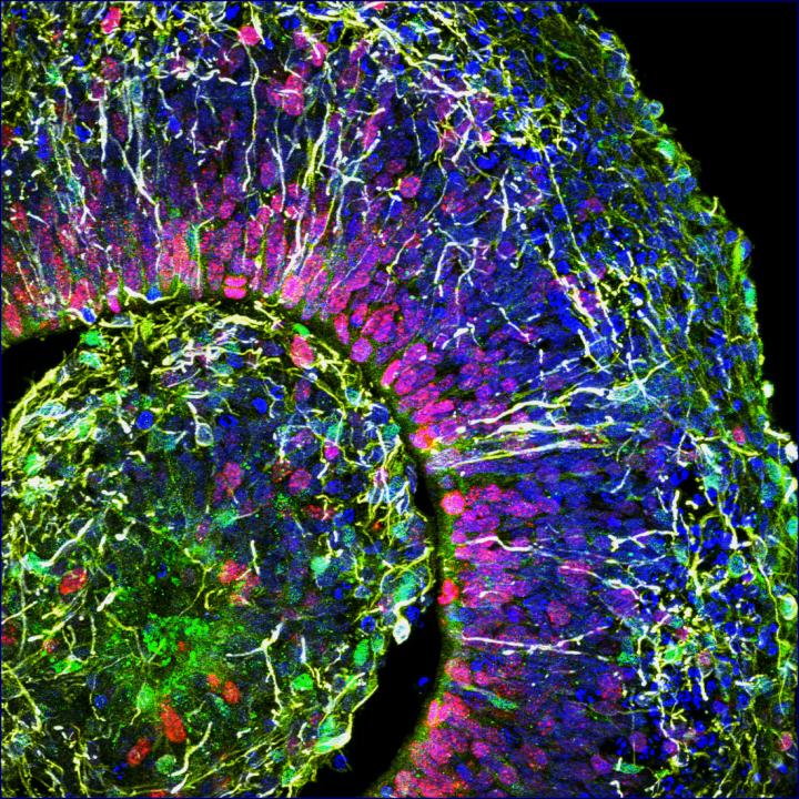Brain Organoid Cross-Section