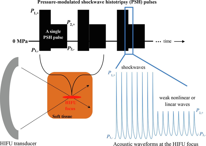 Development of Precision Focused Ultrasound Surgery Technology Destructing Only the Desired Tissues