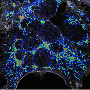 Microscope image of mitochondria