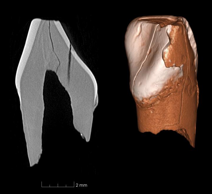 Ancient Teeth Inform Humans' Arrival in Europe (3 of 8)