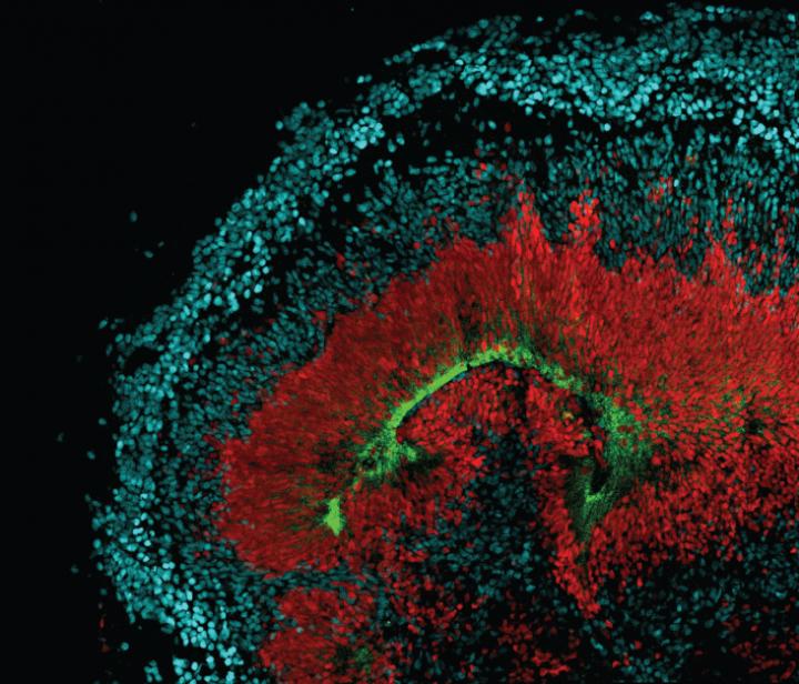 Stem Cell-Derived Cerebral Organoid