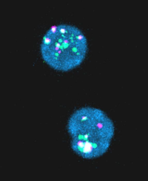 HIV expression in "dormant" ce [IMAGE] EurekAlert! Science News Releases