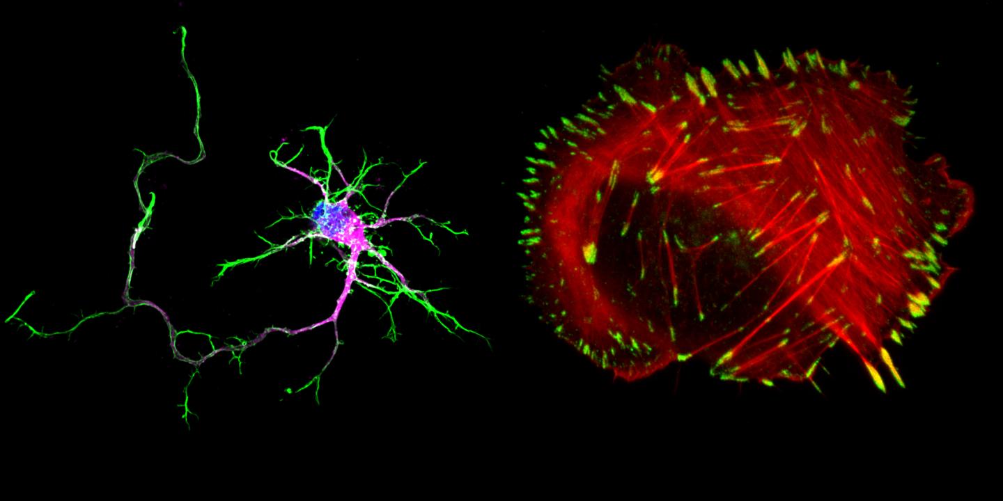 Neuron vs Cancer Cell