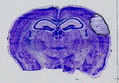 Stroke Size With Gap 19 treatment