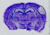 Stroke Size With Gap 19 treatment