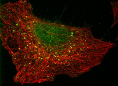 Defective Dynamin 2 Hampers Cells
