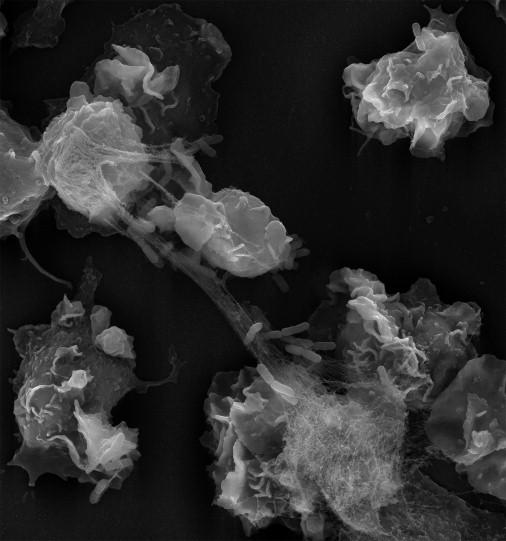 Bacteria Trapped in a NET