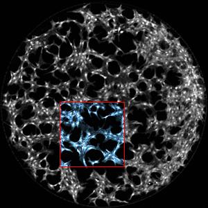 Microscopic Image of Fibroblast Cells