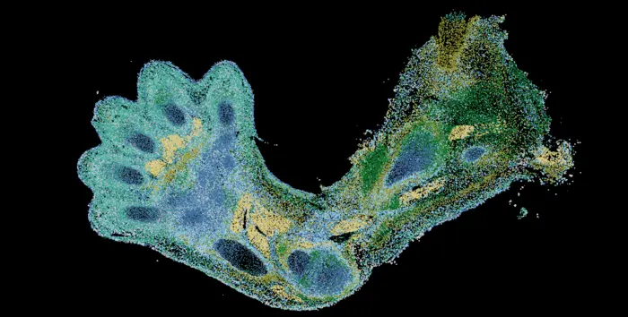 Spatial transcriptomics of developing upper limb