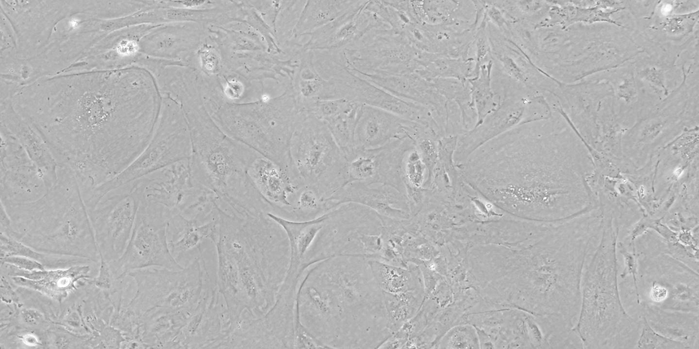 Induced Pluripotent Stem Cells