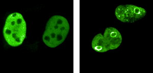 MYC Proteins in Cancer Cells