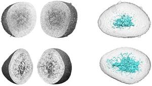 Xray microscopy