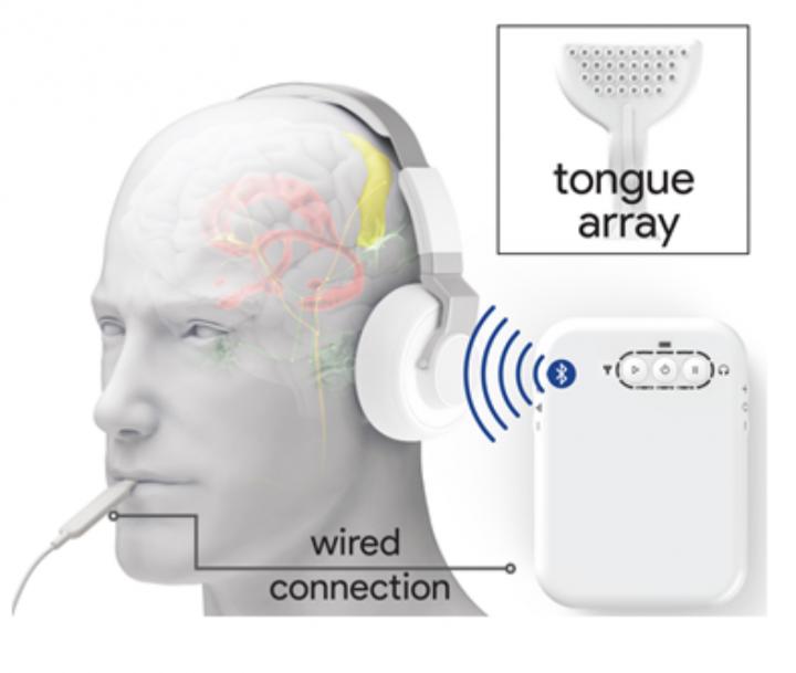 Sensory Device Stimulates Ears and Tongue to Treat Tinnitus in Large Trial (1 of 9)