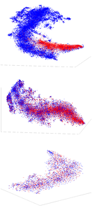 Machine Learning Determines Uncertainty in Breast Cancer Diagnoses