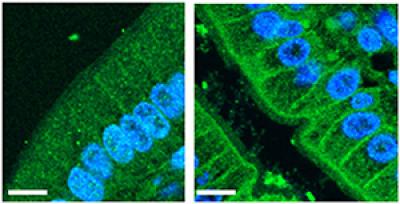 New Culprit Identified in Metabolic Syndrome
