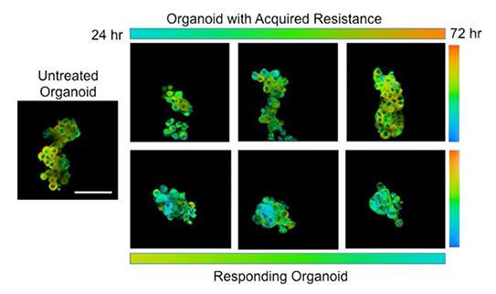 Tumor Time Sequence