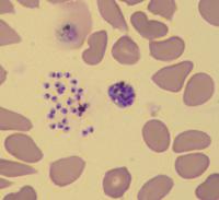 Red Blood Cells Infected by the Malaria Parasite