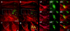 Dual-color OLID-SDOM imaging of lysosomes and actin in U2OS cells