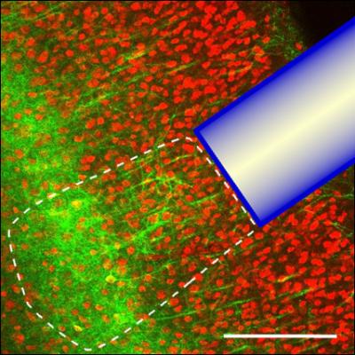 Optogenetic Stimulation and Detection of Ca Waves