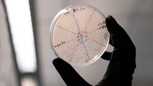 Yeast plate in the Shipman Lab at Gladstone Institutes