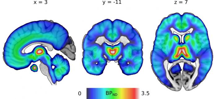 Distribution of &#956;-Opioid Receptors in the Human Brain