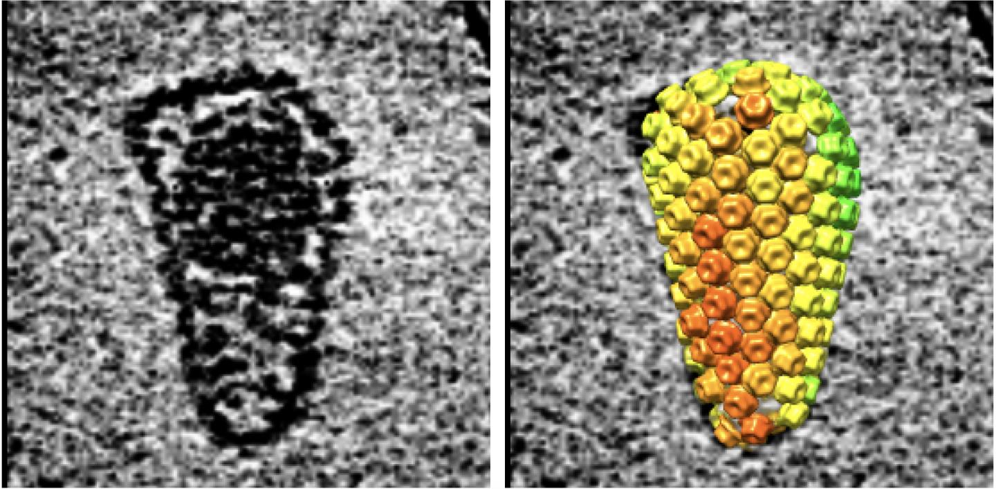 An Up-close View of HIV