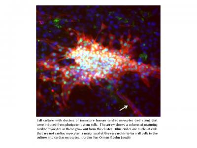 Human Beating Heart Cells