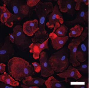 Microglia Immunofluorescence